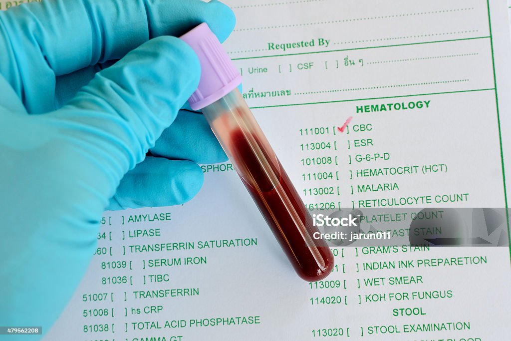 Blood sample for CBC testing Blood sample for CBC (complete Blood Count) testing Medical Exam Stock Photo