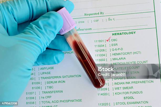 Blood Sample For Cbc Testing Stock Photo - Download Image Now - Medical Exam, Medical Test, Scientific Experiment