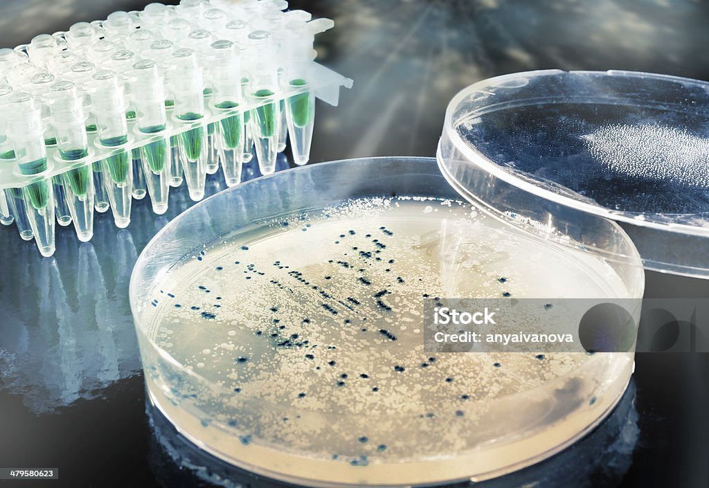 Heben Bakterien- Kolonien von agar plate - Lizenzfrei Agargel Stock-Foto