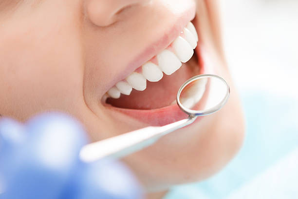 close-up of женщина с ее зубы рассмотрел - зубной hygiene стоковые фото и изображения