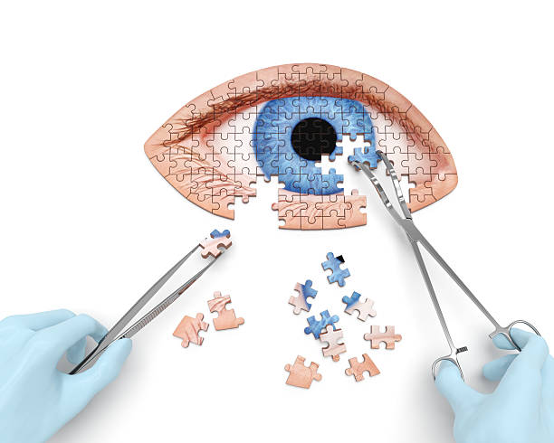 Cataract Surgery Stock Photos, Pictures & Royalty-Free Images - iStock