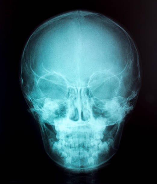 istock X-Ray Image Of Human  for a medical diagnosis 479715547