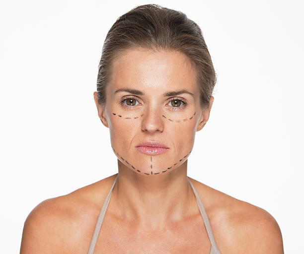 istock woman with plastic surgery marks on face 479946741