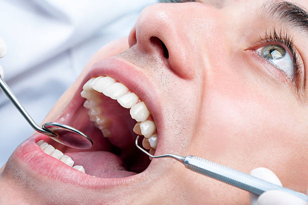 istock Young man whitening teeth at dentist. 480106686