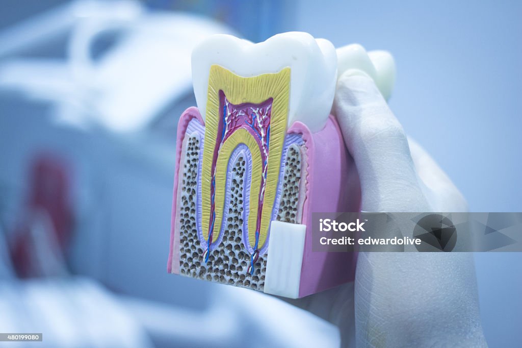 Tooth Embeeding Cast Dental Tooth Model Cast Showing Decay Enamel Roots Stock Photo ...