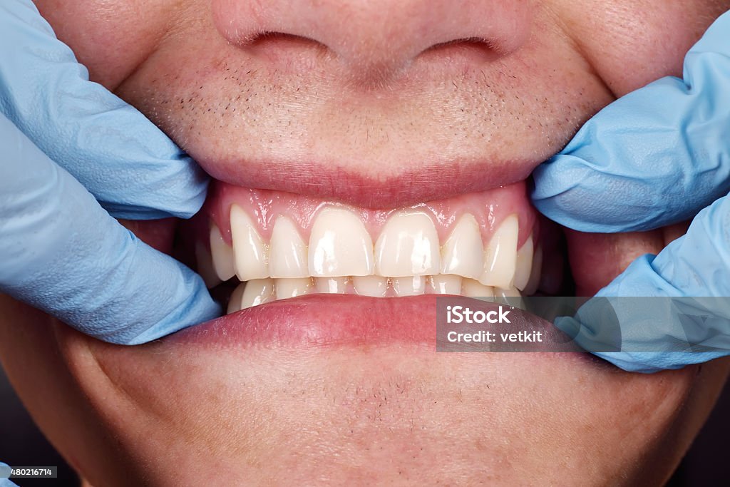 Dentist shows a patient's teeth Dentist shows a patient's teeth, close up Human Gums Stock Photo