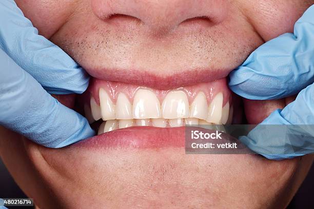 Dentist Shows A Patients Teeth Stock Photo - Download Image Now - Human Gums, Smiling, Brushing