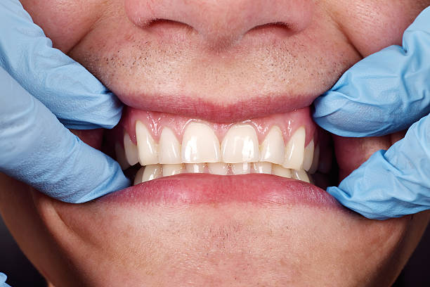 стоматолог показывает пациента зубьев - dental floss brushing teeth dental hygiene dental equipment стоковые фото и изображения