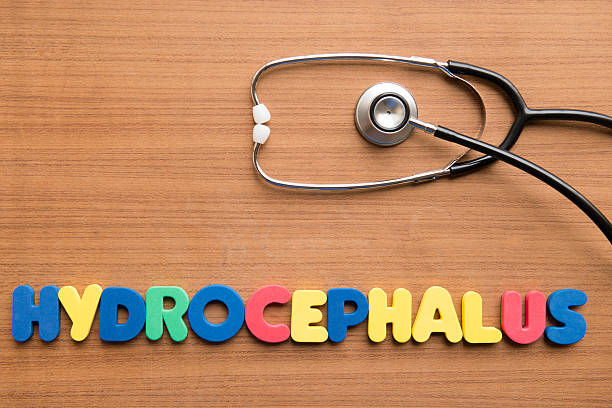Hydrocephalus stock photo
