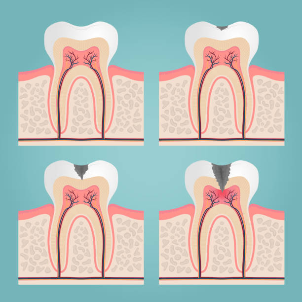 ilustrações de stock, clip art, desenhos animados e ícones de anatomia do dente - human teeth dental hygiene anatomy diagram