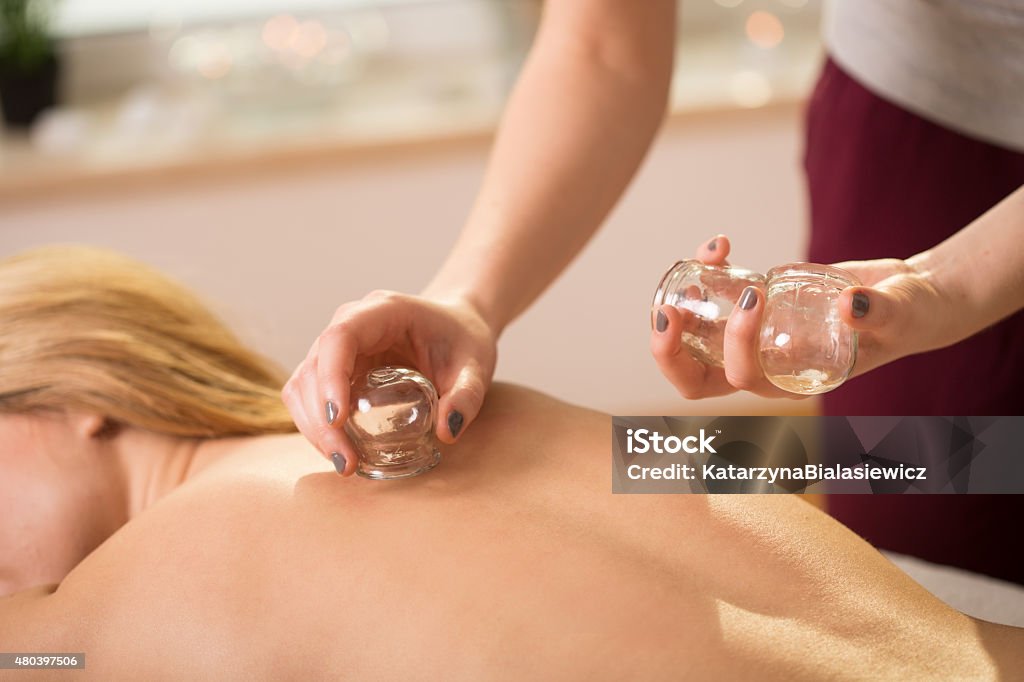 Cupping therapy Young woman having cupping therapy on her back Vacuum Cupping Stock Photo