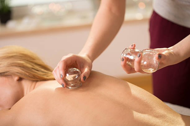 Cupping therapy Young woman having cupping therapy on her back cupping therapy stock pictures, royalty-free photos & images