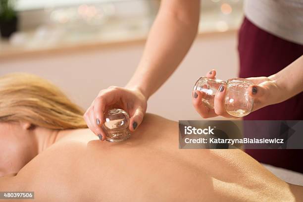 Cupping Therapy Stock Photo - Download Image Now - Vacuum Cupping, Bubble, Chinese Culture