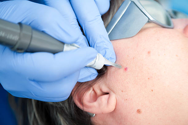 istock Medical Laser 480412999