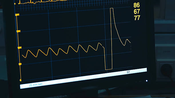 istock Diagram of vital indicators on screen 480609524