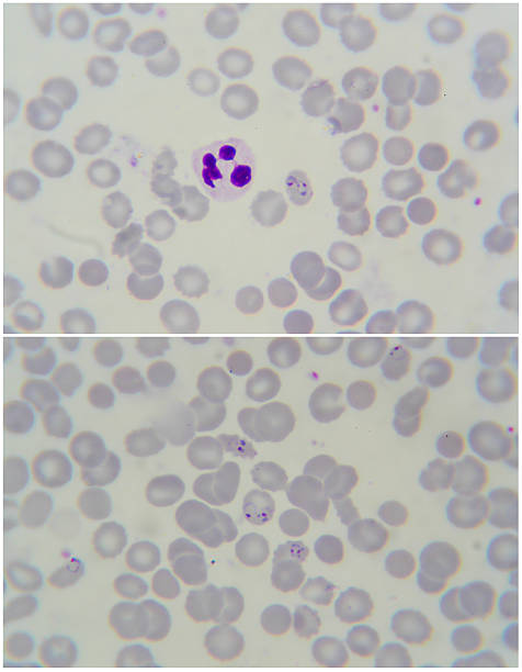Malaria parasite under microscope 1000x Deep focus , Malaria parasite (p.f) shoot by DSLR under microscope 1000x malaria blood sample stock pictures, royalty-free photos & images