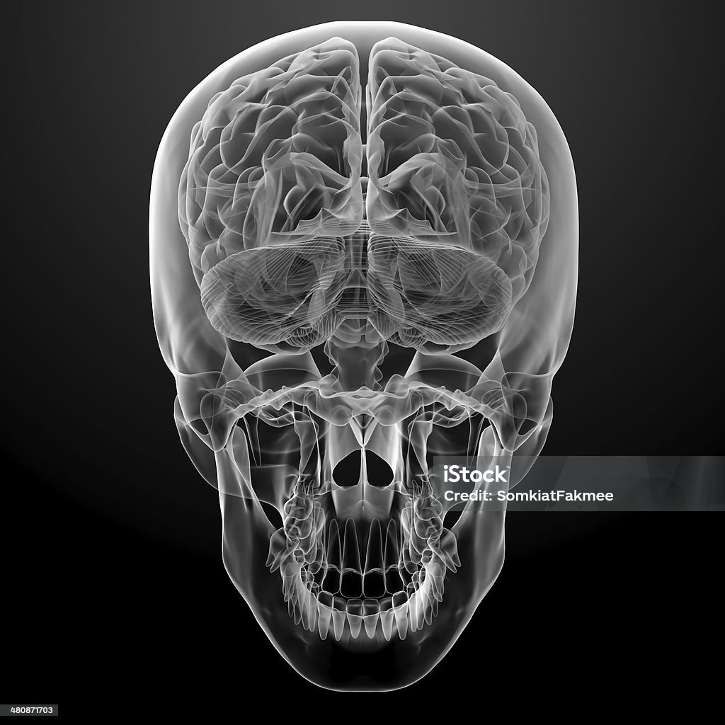 Cervello umano X ray - Foto stock royalty-free di Anatomia umana