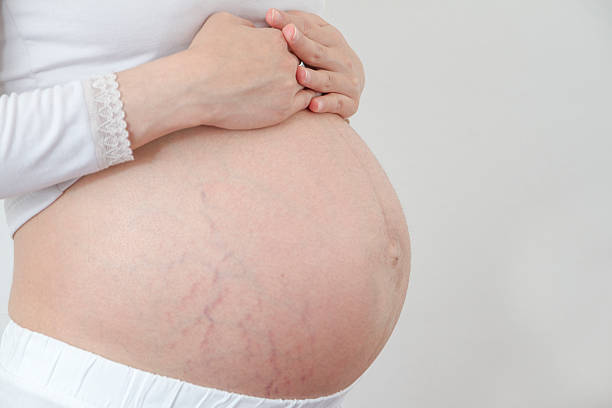 der schwangerschaft schwangerschaftsstreifen - human pregnancy abdomen naked human hand stock-fotos und bilder
