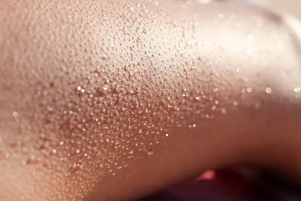 Woman's legs with goosebumps macro sunset cold