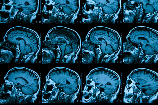 radiografia di un teschio umano - mri scan cat scan machine x ray brain foto e immagini stock