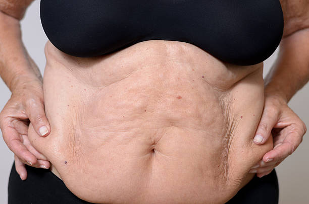 istock Close up Middle Aged Woman Holding her Fatty Belly 481087236