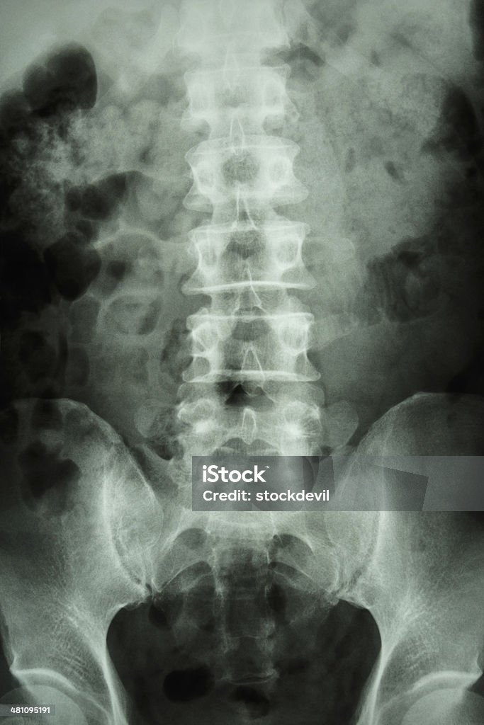 Humanos normales de la columna vertebral lumbar sacro - Foto de stock de Adulto libre de derechos