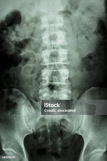 Humanos Normales De La Columna Vertebral Lumbar Sacro Foto de stock y más banco de imágenes de Adulto