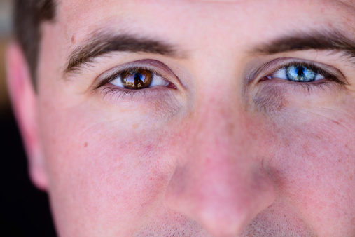 A close up of a man with two different colored eyes, Heterochromia iridum.