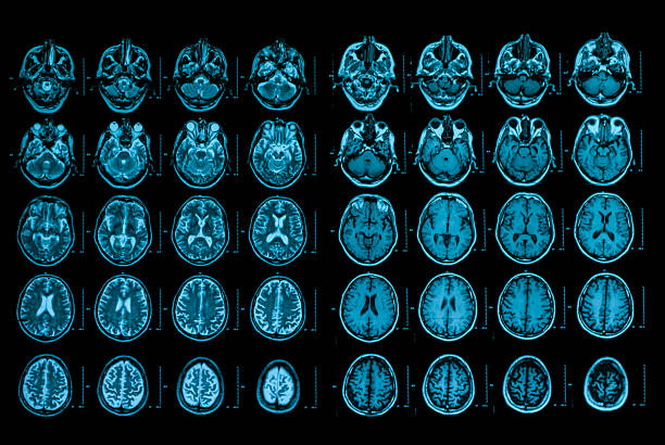 radiografia di un teschio umano - mri scan cat scan machine x ray brain foto e immagini stock