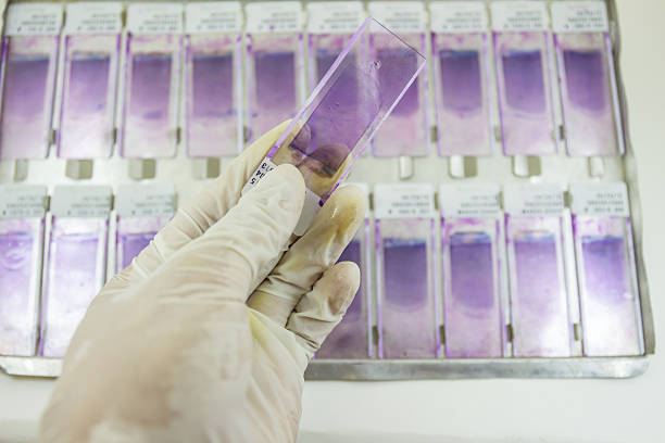 istock Slide blood  smear for hematology laboratory. 481170948