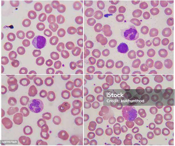 Blood Type Microscope Lab Human Blood Cell Under Microscope 1000x Stock Photo - Download Image ...