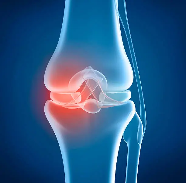 Photo of Knee problem, x-ray view