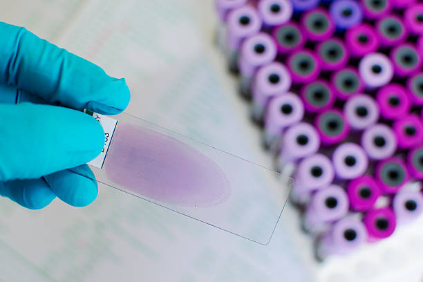 Wright stained blood film Wright stained blood film for microscopic examination malaria blood sample stock pictures, royalty-free photos & images