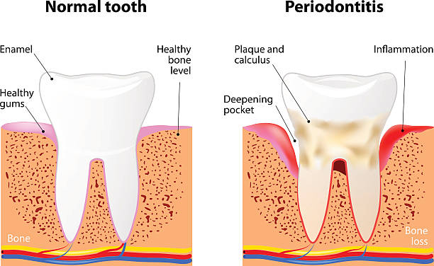 ilustrações de stock, clip art, desenhos animados e ícones de frequentes (grau 3 ou 4) - human teeth dental hygiene anatomy diagram