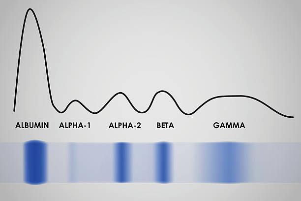 Blood serum protein electrophoresis electrophoretogram Typical result of blood serum protein gel electrophoresis test naming organic compounds stock illustrations