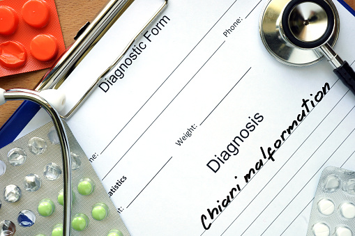 Diagnosis  Chiari malformation, pills and stethoscope.