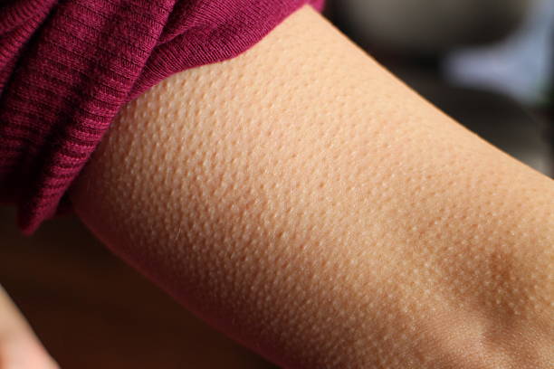 Skin Goosebumps Close-up