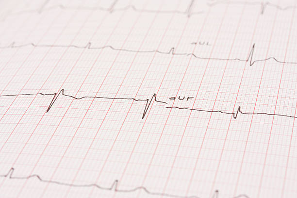 istock Detail of an electrocardiogram 481761488