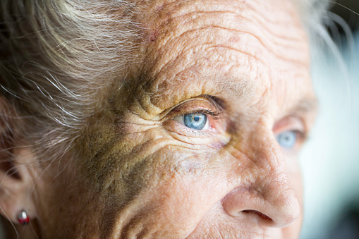 Face of an elderly senior caucasian woman that has been abused. She has a black eye. Her face is discolored near her eye.  Face only is visible. She has blue eyes, grey hair, and a wrinkled complexion. She is wearing pearl earrings. Shot with a Canon 5D Mark 3.  rm