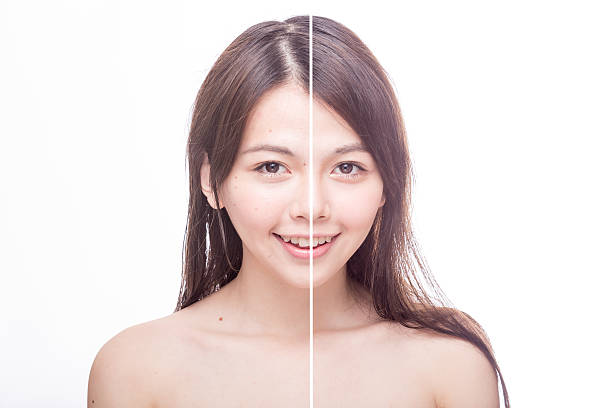 istock Before and after beauty portrait 481952420