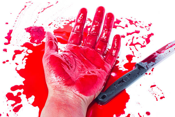 istock Dead hand with blood and knife 481990438