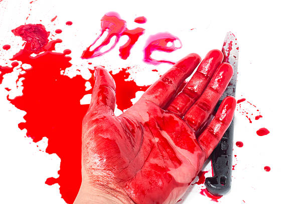 istock Dead hand with blood and knife 481990440
