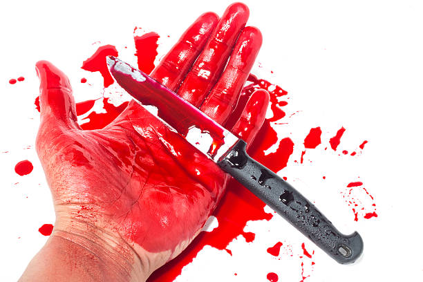 istock Dead hand with blood and knife 482068500