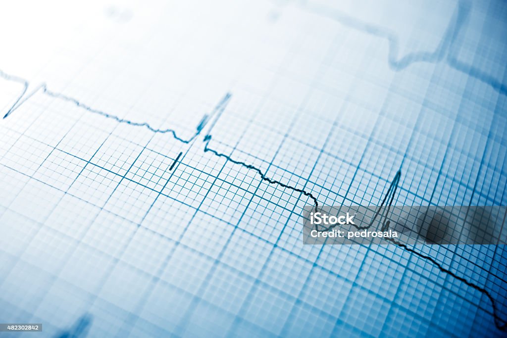 Electrocardiogram Close up of an electrocardiogram in paper form. Electrocardiography Stock Photo