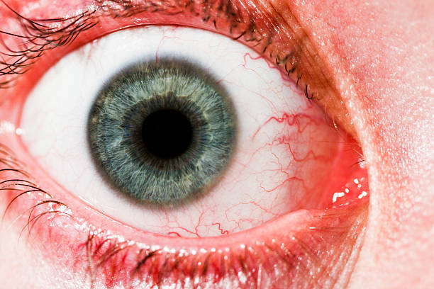 red eye - eyeball large human eye human nose stock-fotos und bilder