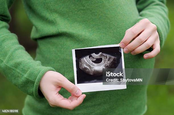 Ultrasound Photographs Of Pregnancy Stock Photo - Download Image Now - 2015, Adult, Affectionate