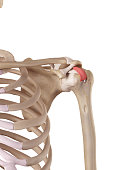 das-quer-humeral-ligament.jpg?b=1&s=170x170&k=20&c=WiJ74Wm1OEcIX6RRYv4XuZrsQvVdy90t64jxEY6qBFg=