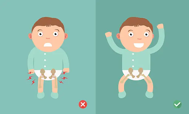 Vector illustration of Best and worst positions child for prevention of hip dysplasia