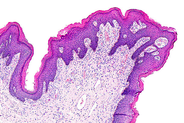 papiloma de la piel de un humanos - microscope slide fotografías e imágenes de stock
