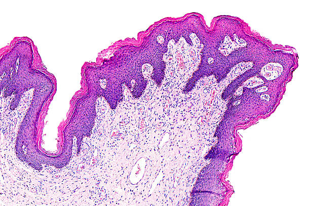 папиллома кожи с человека - magnification high scale magnification cell scientific micrograph стоковые фото и изображения